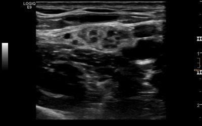 Case of the month – November