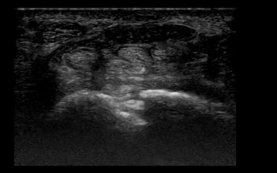 Case of the month – December