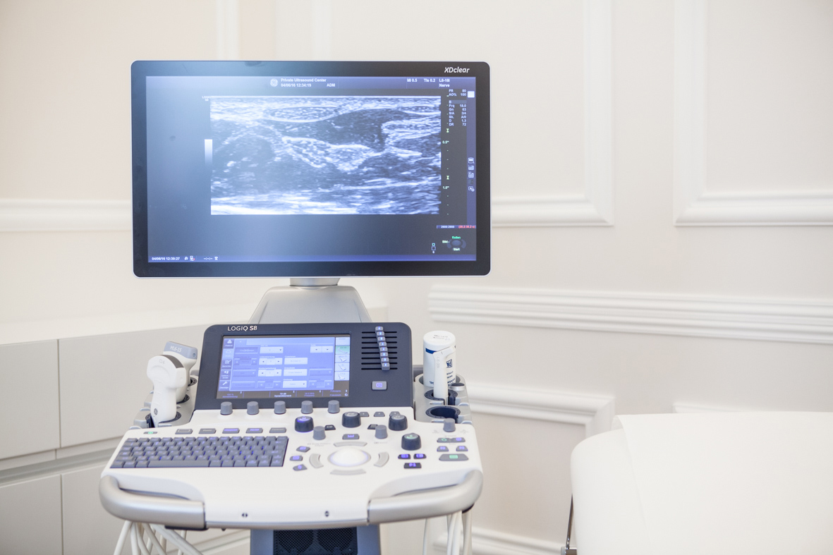 FeaturedPicSetUp 10 Reasons Why You Should Start With Nerve Ultrasound Today