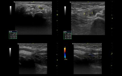 How to set up your own neuromuscular ultrasound lab – a stepwise guide from idea to scanning Part 4b