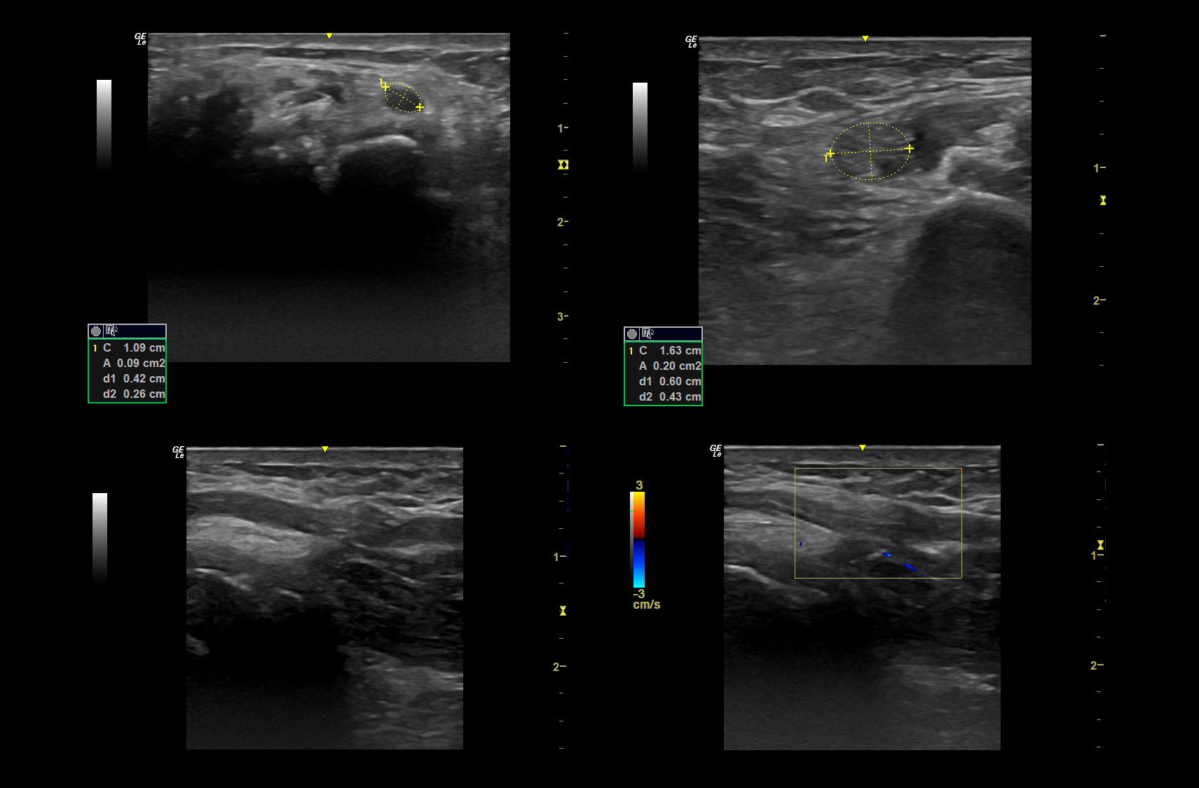 10 Reasons Why You Should Start With Nerve Ultrasound Today